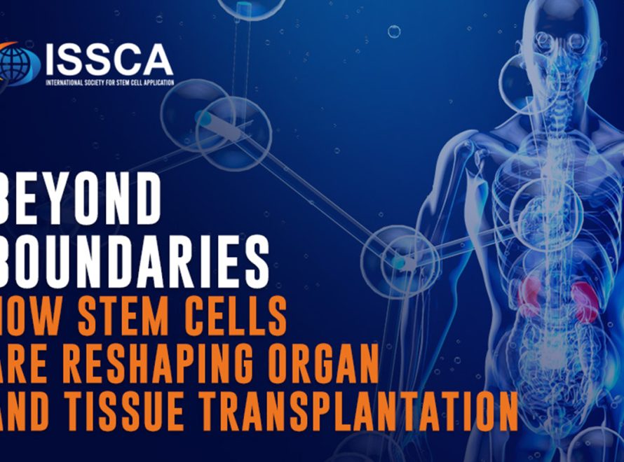 Stem cell transplantation