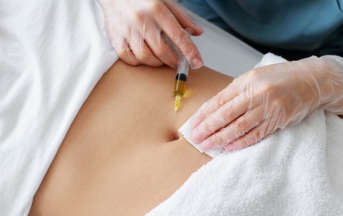 nano fat grafting image